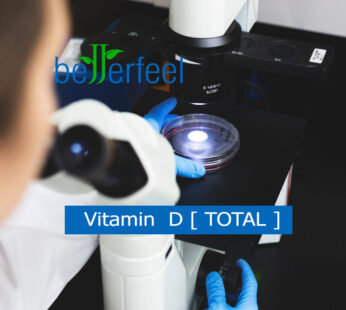 Vitamin  D [ TOTAL ]