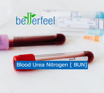 Blood Urea Nitrogen [ BUN]