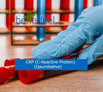 CRP (C-Reactive Protein) (Qauntitative)