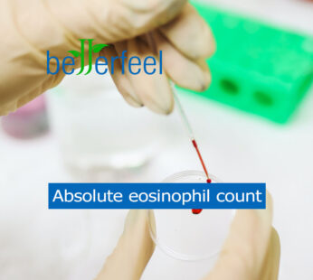 Absolute eosinophil count