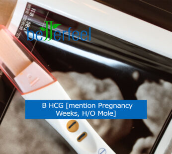 B HCG [mention Pregnancy Weeks, H/O Mole]